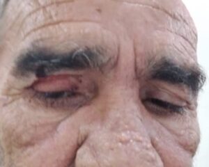 Leia mais sobre o artigo Secretário do governo de Fábio do Pastel agride blogueiro em São Pedro da Aldeia