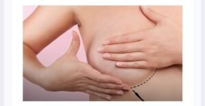 Leia mais sobre o artigo CIRURGIAS PLÁSTICAS REPARADORAS DEVOLVEM AUTOESTIMA A PACIENTES COM CÂNCER DE MAMA E GANHAM REFORÇO COM LEI DA ALERJ